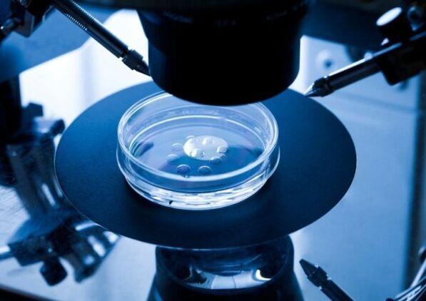英国科学家冷冻患癌女童卵子 或助其长大后生