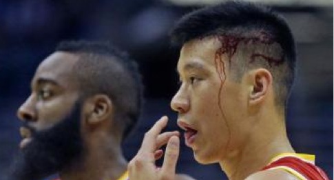 辛酸!亚裔在NBA受尽歧视,林书豪被骂滚回中国