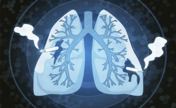 微软:网页搜索数据能帮医生尽早确诊肺癌 - 科