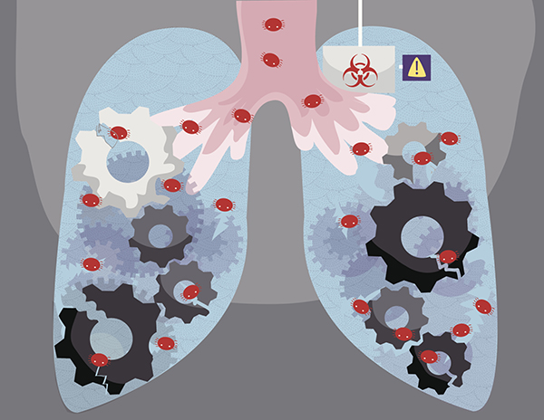 肺结节不等于早期肺癌,质子重离子治疗适用哪