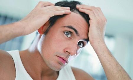 男性脱发增长10倍 6招防发际线上移 - 健康 - 东
