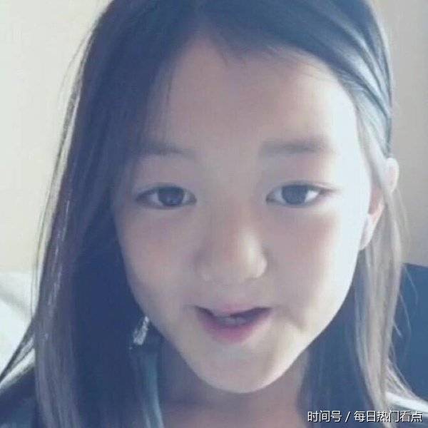 王菲10岁女儿李嫣兔唇修复明显变好,活泼可爱